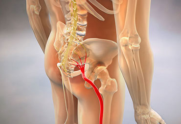 Diagram of sciatic nerve